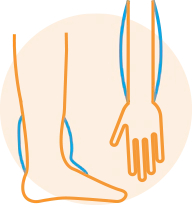 Swelling in the ankles, arms, or stomach area