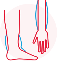 Swelling in the ankles, arms, or stomach area